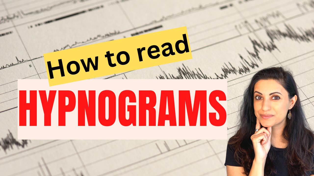 How to Read Hypnograms